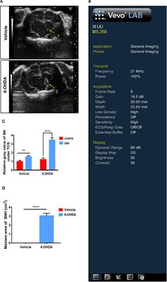 Substantia Nigra Hyperechogenicity Reflects the Progression of Dopaminergic Neurodegeneration in 6-OHDA Rat Model of Parkinson’s Disease